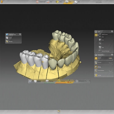 inLab CAD Software, Jaw-Oriented Biogeneric Setting