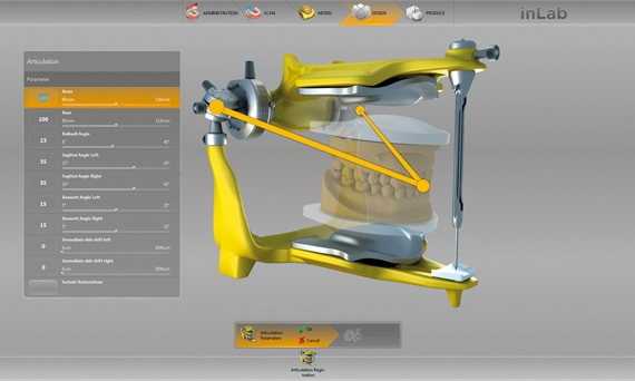 inLab CAD Software, Basic module, virtual articulator