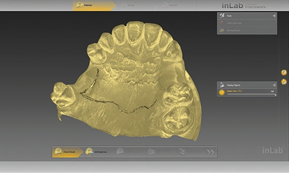 inLab CAD Software, entering line texture for partial denture