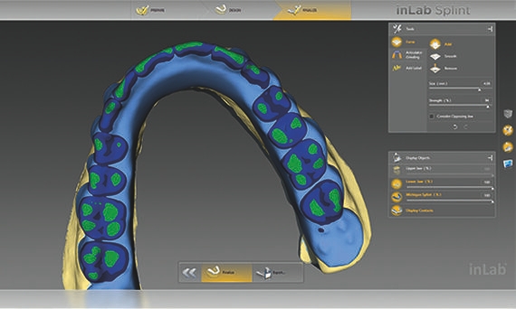 inLab CAD Software, consideration of opposing teeth for the design of a splint