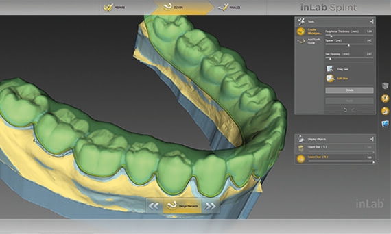 inLab CAD Software, individual design of a splint