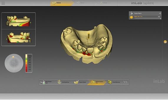 inLab CAD Software, contour of individual impression tray