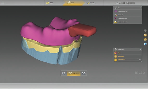 inLab CAD Software, options for handling an individual impression tray
