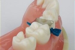 Class 2 dental procedure tooth prepping with interproximal guard