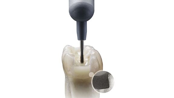 SDR Flow Plus tooth application 